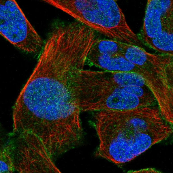Anti-ATP2B1