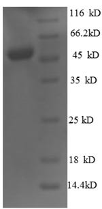 Homeobox protein OTX2 (OTX2), human, recombinant