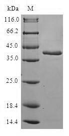 Retinol-binding protein 2 (RBP2), human, recombinant