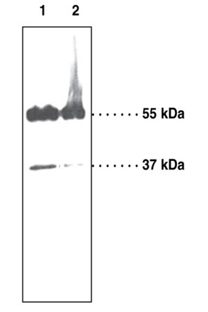 Anti-Melanocortin-4 Receptor