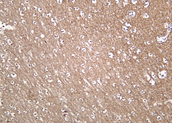 Anti-Recombinant Trk A, clone 4D4