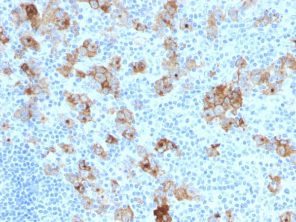 Anti-CD30 / TNFRSF8 (Hodgkin &amp; Reed-Sternberg Cell Marker), clone SPM121