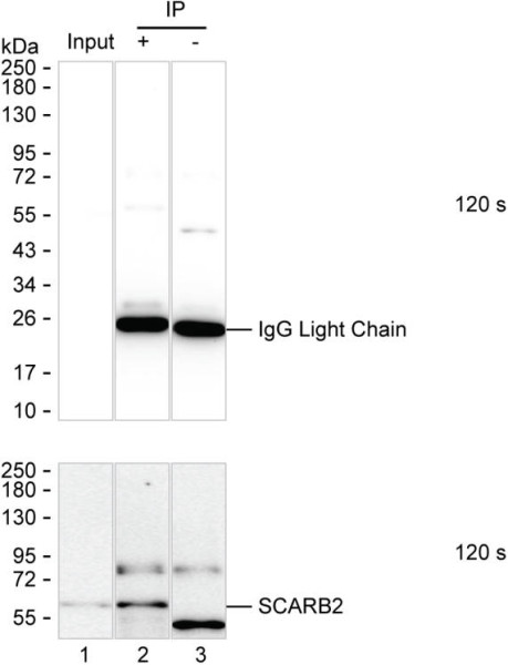 Anti-Lysosome Membrane Protein 2