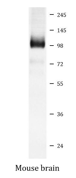 Anti-mGluR1