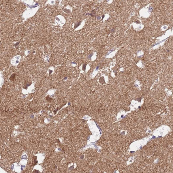 Anti-HCN1