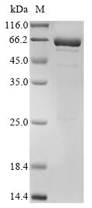 Interleukin-11 (IL11), Biotinylated, Macaca fascicularis, recombinant
