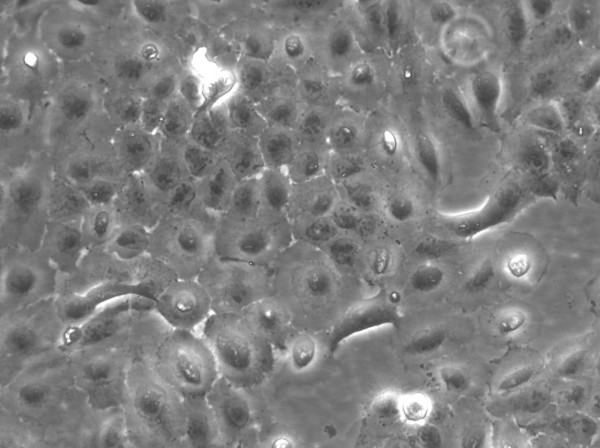 DU-145 Cells