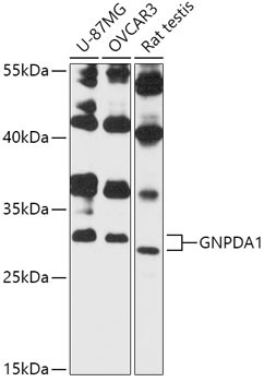Anti-GNPDA1