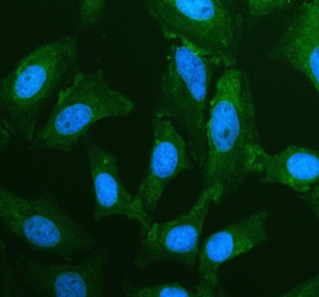 Anti-PDE8B / Phosphodiesterase 8B