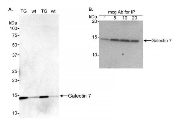 Anti-Galectin-7