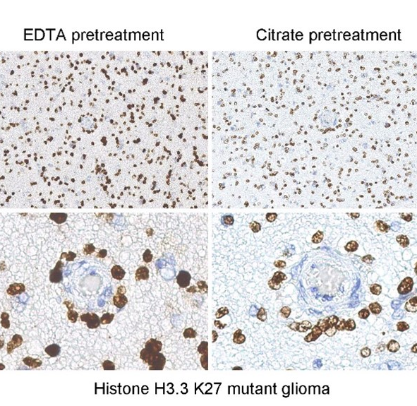 Histone H3 Mutation Antibody Panel (K4M, K9M, K27M, K36M)