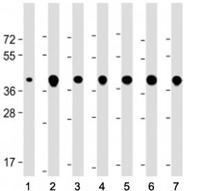 Anti-TOMM40 (N-Terminal Region)