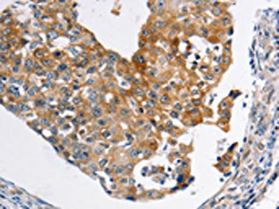 Anti-ABCC3