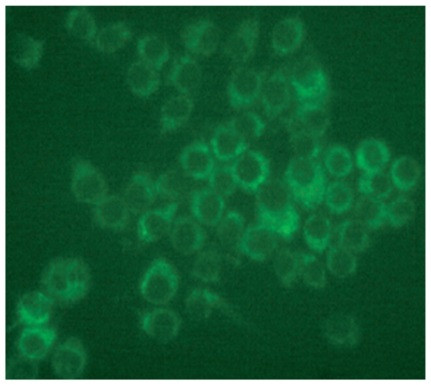 Anti-LDL receptor