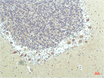 Anti-PPARD Monoclonal