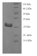Telomerase protein component 1 (TEP1), partial, recombinant human