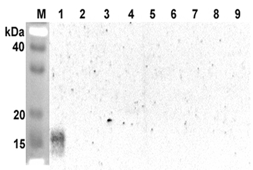 Anti-ANGPTL5 (coiled-coil domain) (human)