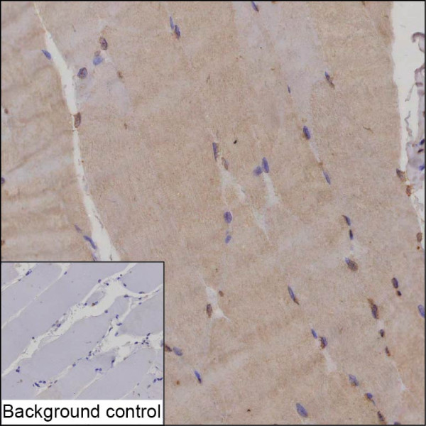 Anti-ACYP2