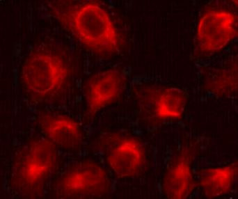 Anti-CBR1, clone 2C9-B12-C4