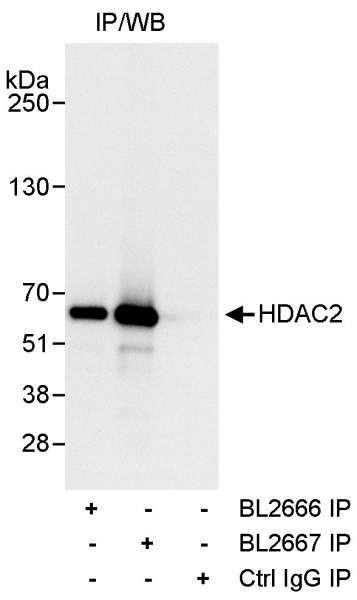 Anti-HDAC2