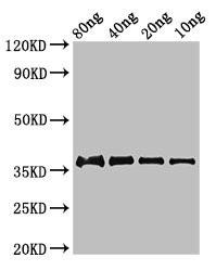 Anti-fbpC