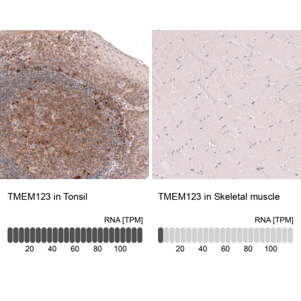 Anti-TMEM123, clone CL14381