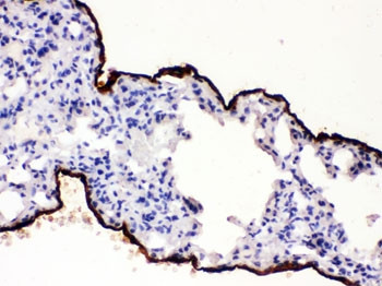 Anti-Mesothelin
