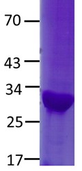 NFE2L2 Protein R34Q mutant