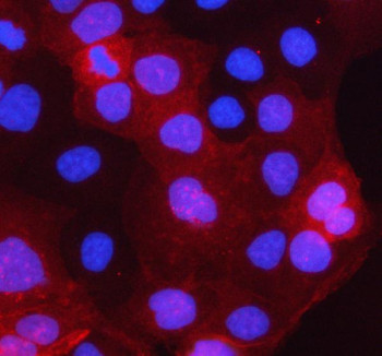 Anti-STARD10 / StAR-related lipid transfer protein 10 / PCTP-L