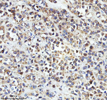 Anti-STRIP2 / Striatin-interacting protein 2