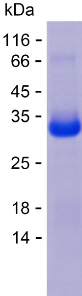 Recombinant Human RHOT1 Protein