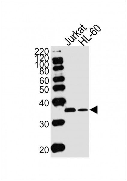 Anti-Thymidylate Synthase