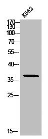Anti-Phospho-MCL1 (S159)