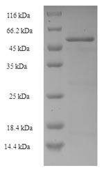 Methyl-accepting chemotaxis protein II (tar), partial, Escherichia coli, recombinant