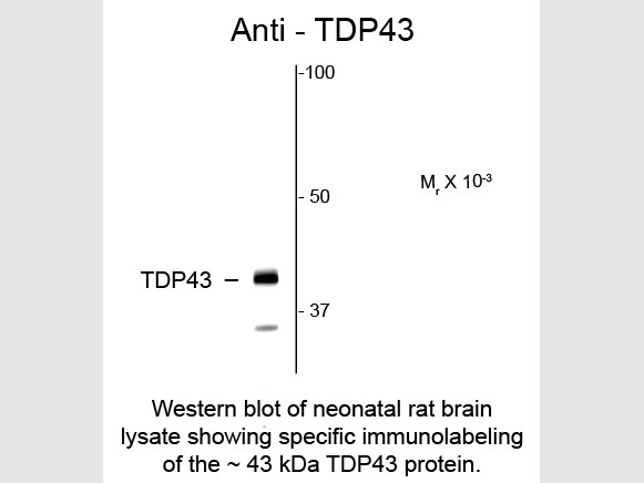 Anti-TDP43