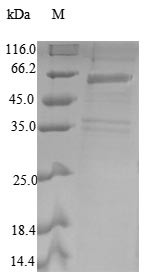 COP9 signalosome complex subunit 2 (COPS2), human, recombinant