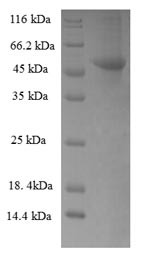 Ribokinase (RBKS), partial, human, recombinant