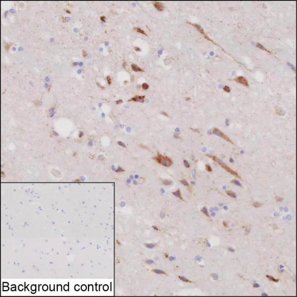 Anti-SPARCL1