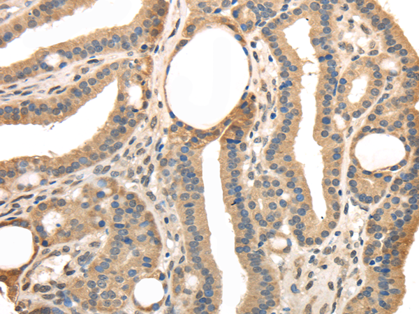 Anti-TRIB3
