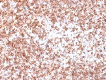 Anti-CD45 / LCA (B-Cell Marker) Recombinant Rabbit Monoclonal Antibody (clone:PTPRC/1975R)