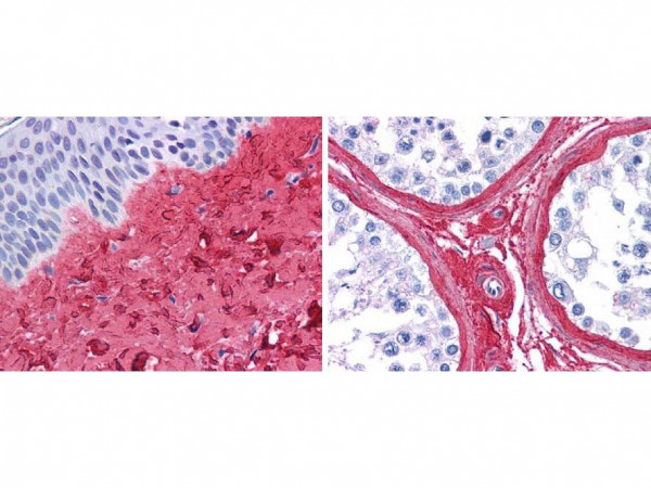 Anti-Collagen Type III, Peroxidase Conjugated