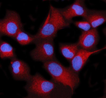 Anti-STIM2 / Stromal interaction molecule 2