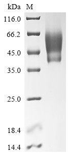 Protein B5 (PS/HR), partial, Vaccinia virus, recombinant