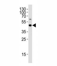 Anti-C9orf72