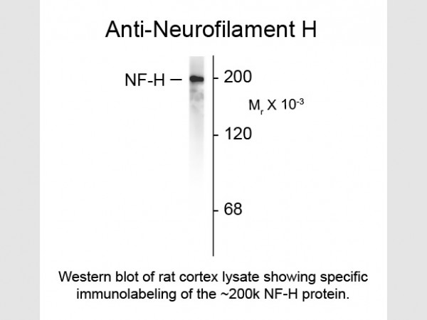 Anti-Neurofilament H