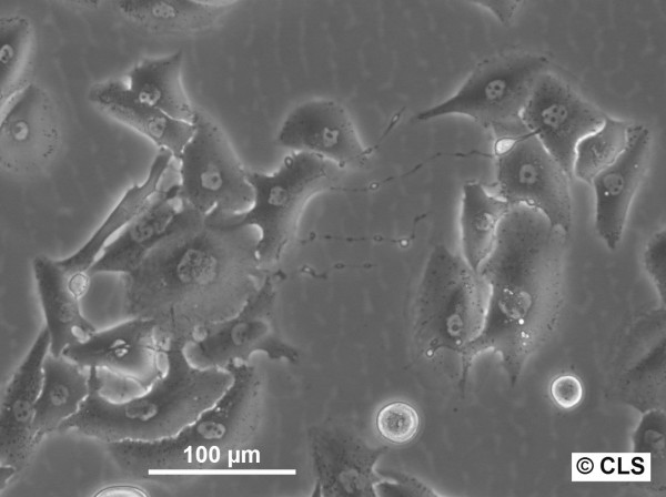 RCC-OF1 Cells