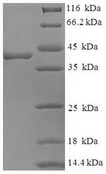 Peptidyl-prolyl cis-trans isomerase FKBP3 (FKBP3), human, recombinant