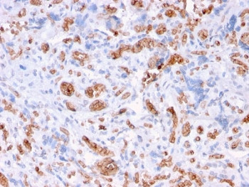 Anti-SPTA1 / Spectrin alpha 1, clone rSPTA1/1832