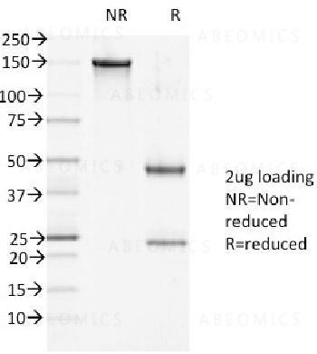 Anti-Desmoglein-1 (DSG1) Monoclonal Antibody (Clone: 27B2)
