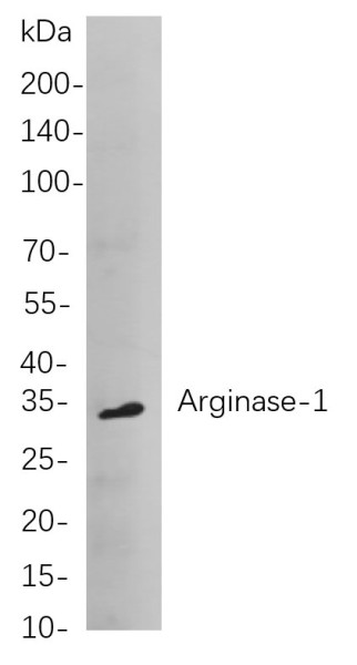 Anti-Recombinant Arginase-1, clone 4D1